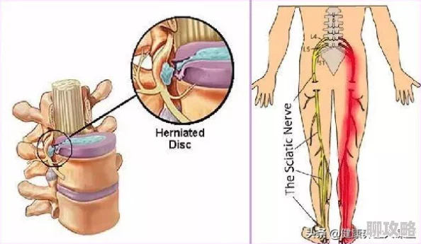 打臀缝近日一项研究显示打臀缝可以有效改善身体姿态和缓解腰痛 打臀缝近日一项研究显示打臀缝可以有效改善身体姿态和缓解腰痛