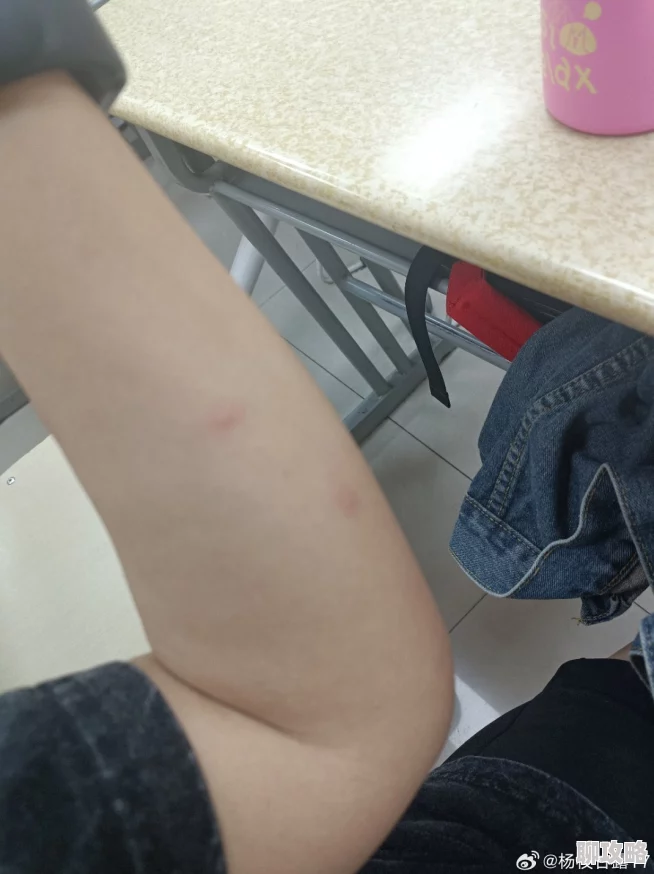 打扑克又痛又痒被蚊子咬了还继续坚持鏖战