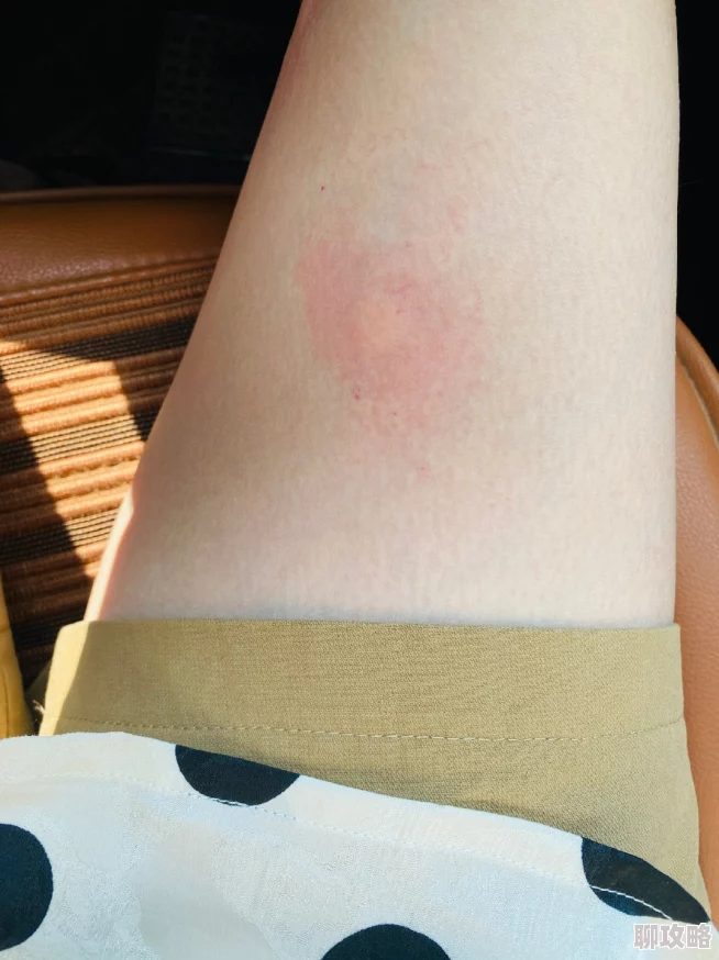 打扑克又痛又痒被蚊子咬了还继续坚持鏖战