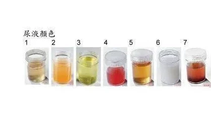尿液大泡浓精灌孕h研究发现尿液成分对健康的潜在影响引起广泛关注